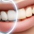 повреждения зубной эмали